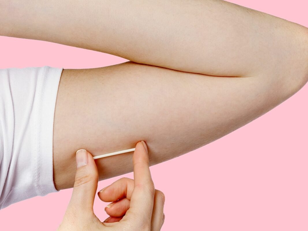 Close-up of a person inserting a Nexplanon birth control implant into the upper arm against a pink background