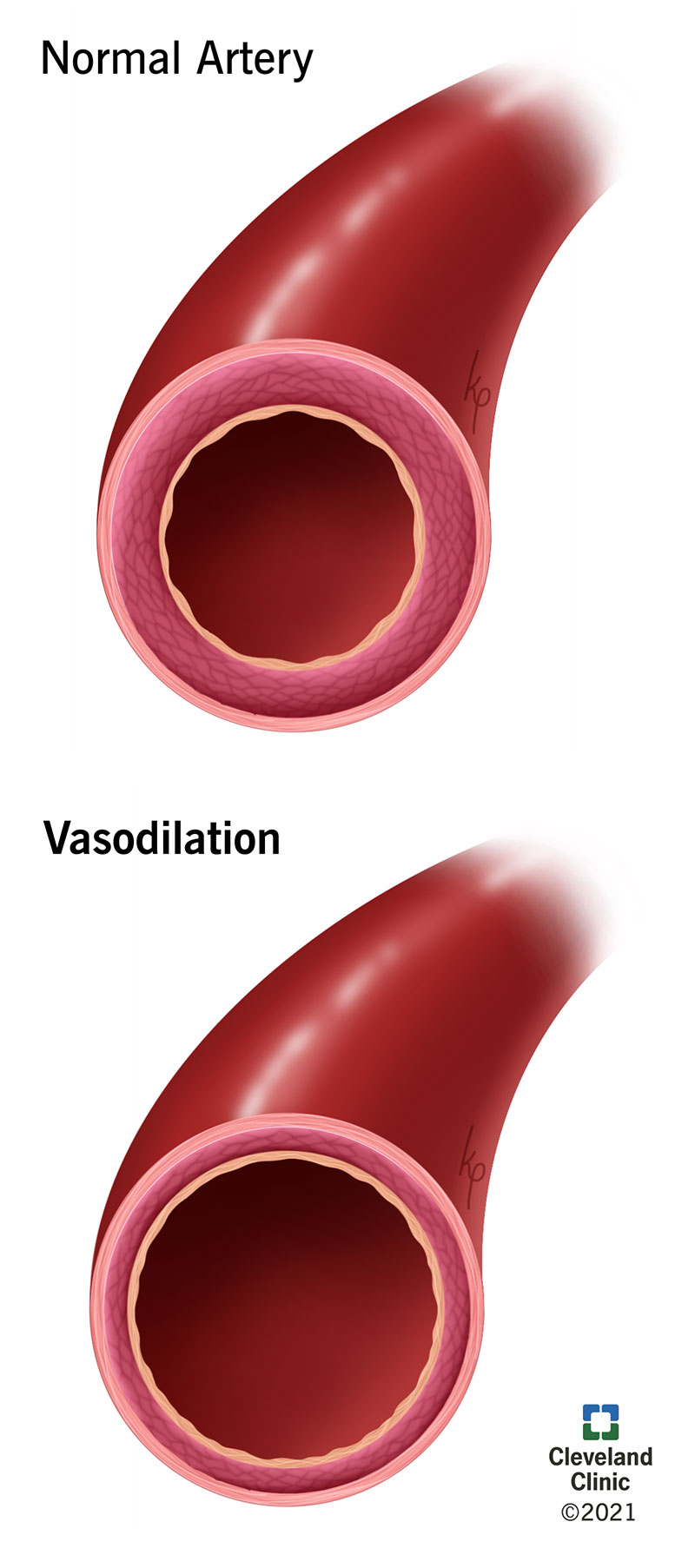Diagram comparing a normal artery to vasodilation, illustrating how ingredients in male supplements like Drivemax and Robust widen blood flow.